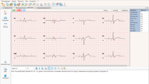 برنامه تجزیه و تحلیل کانتور ECG (اندازه گیری و تفسیر خودکار ECG) POLISPEKTR.NET/آنالیز