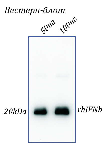 Human IFN-beta Antibody
