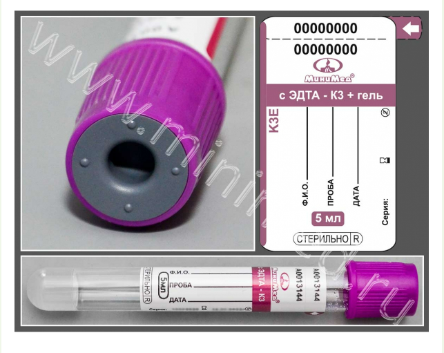 Пробирка вакуумная МиниМед с К3-ЭДТА и разделительным гелем, 5 мл, 13×100мм, фиолетовый, стекло, уп.100 шт