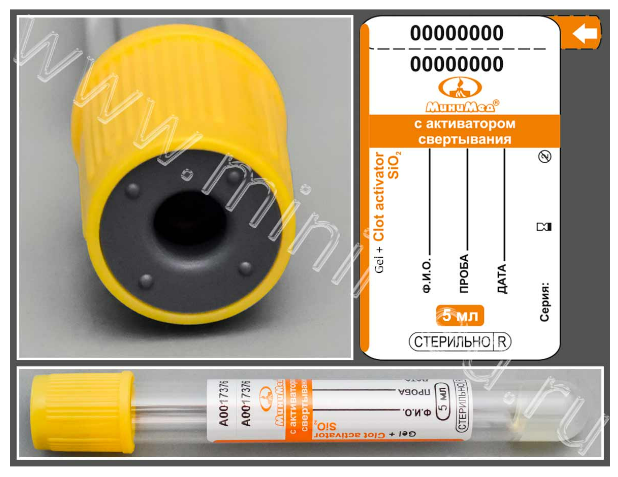 Пробирка вакуумная МиниМед с активатором свёртывания и разделительным гелем, 5мл,13*100 мм, желто-оранжевый, ПЭТФ,уп.100,