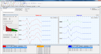 Программа и оборудование для регистрации вестибулярных миогенных вызванных потенциалов МОДУЛЬ ВМВП