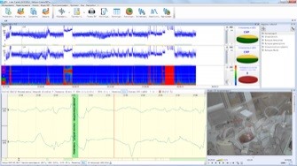 Programa y equipo que convierte un electroencefalograma en un Monitor de función cerebral NEURONA-ESPECTRO-MCF