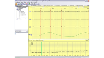 Программа и оборудование для анализа вариабельности ритма сердца