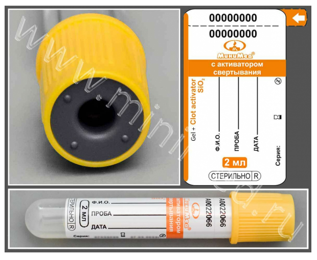 Пробирка вакуумная МиниМед с активатором свёртывания и разделительным гелем, 2мл, 13*75 мм, желто-оранжевый, ПЭТФ,уп.100 шт